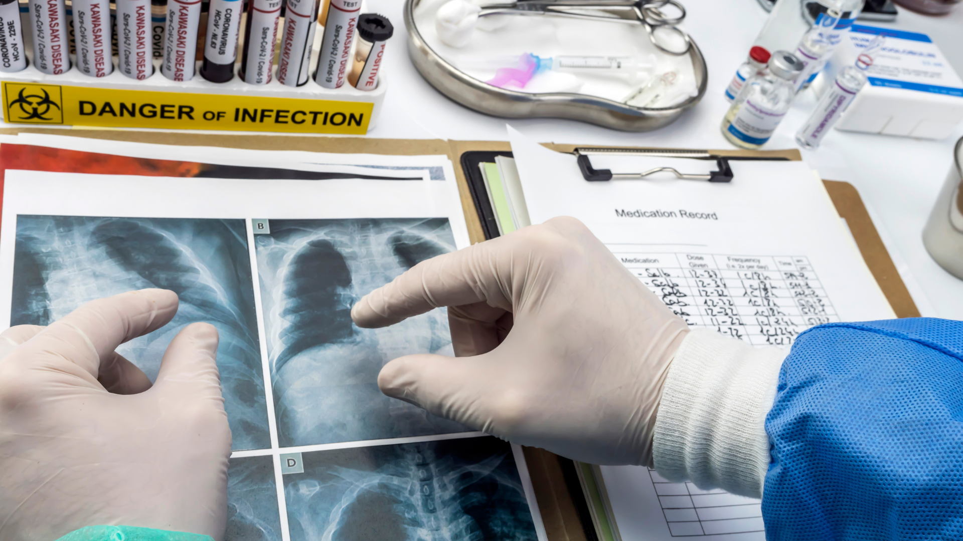 modélisation prédictive des épidémies grâce à l’IA