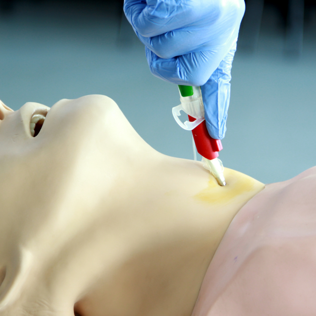 Différence entre trachéotomie et trachéostomie